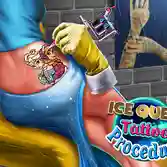 Ice Queen Tattoo Procedure